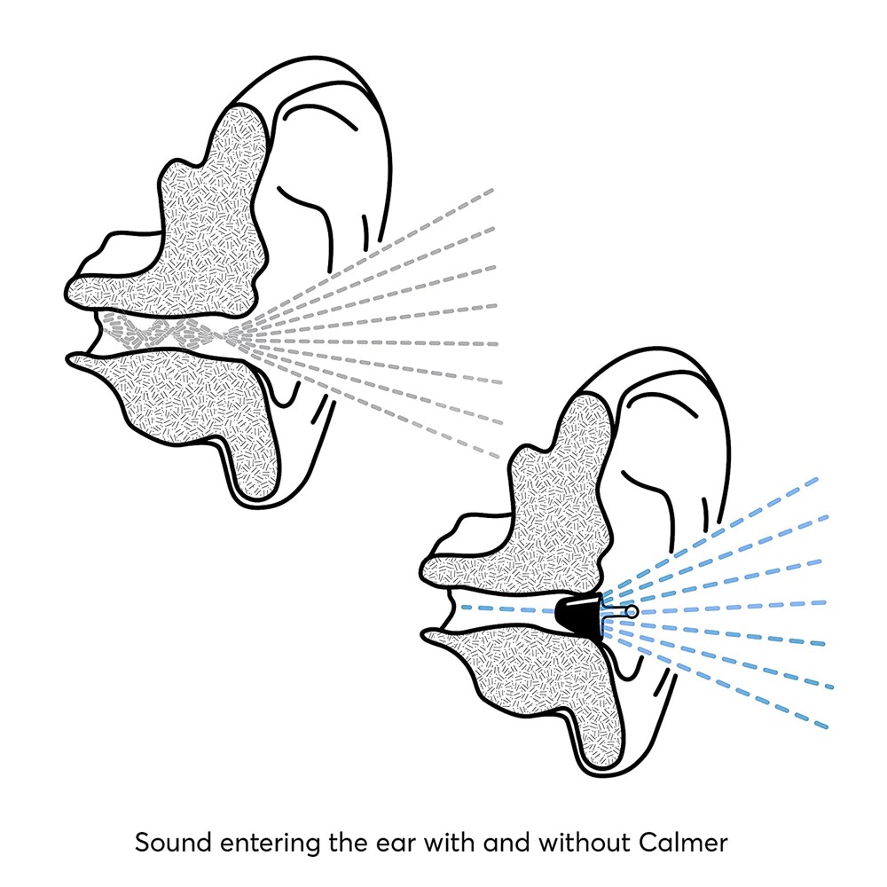 "Buy Online  Flare Audio Calmer (Translucent) Hearing Protection"
